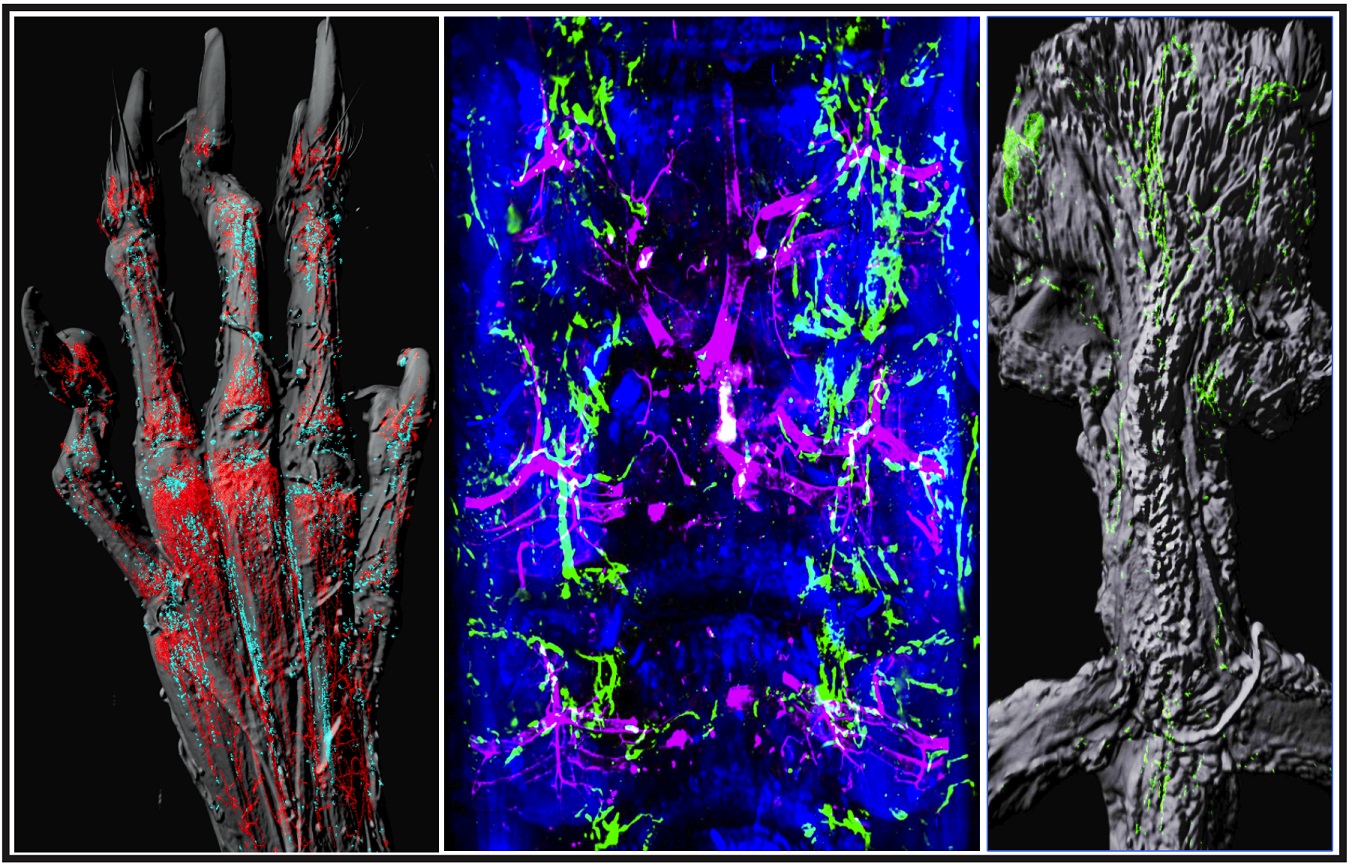 Role Of Lymphatic System In Bone Healing Revealed University Of Oxford